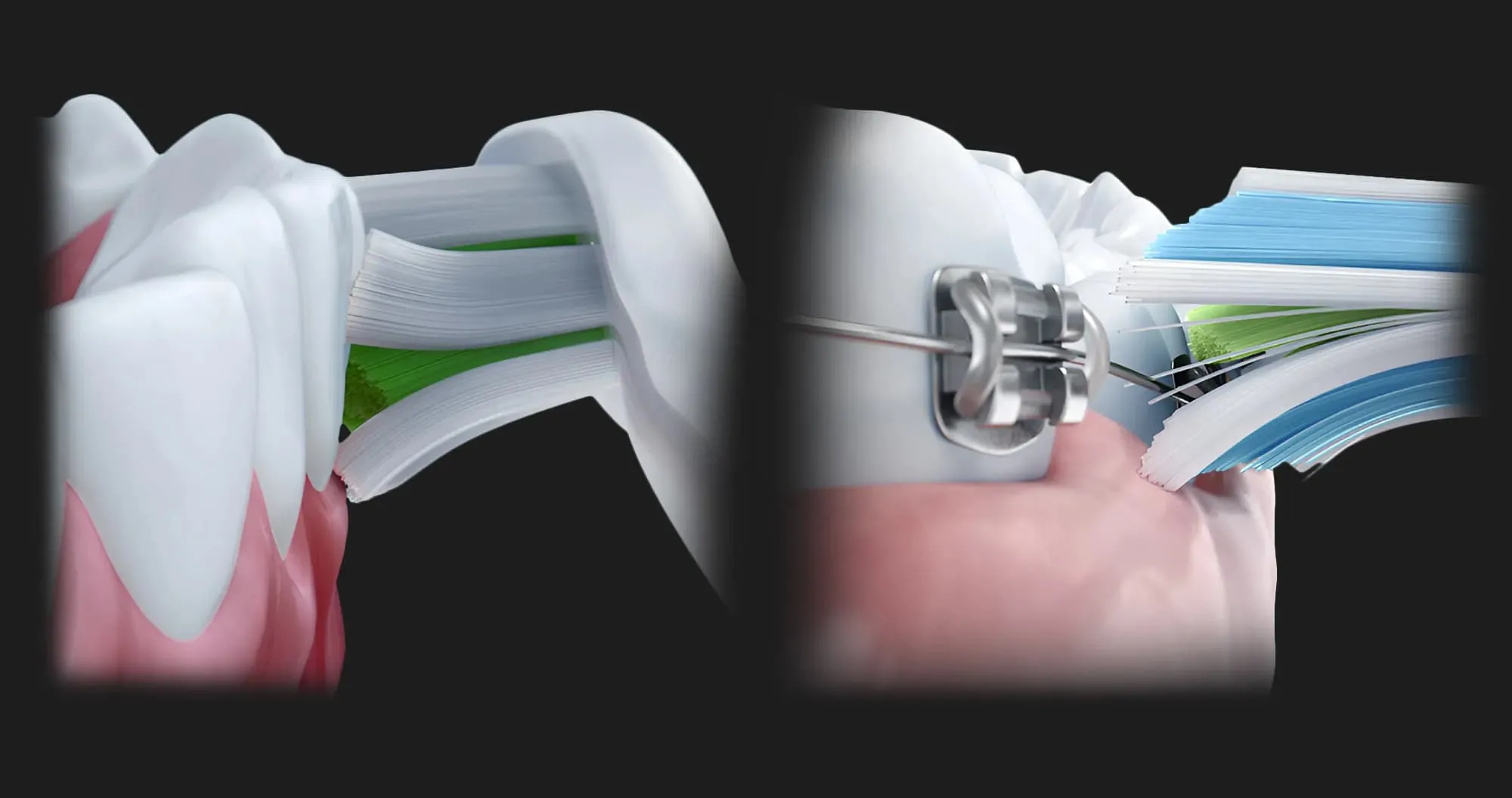 Зубная электрощетка Philips Sonicare ProtectiveClean 5100