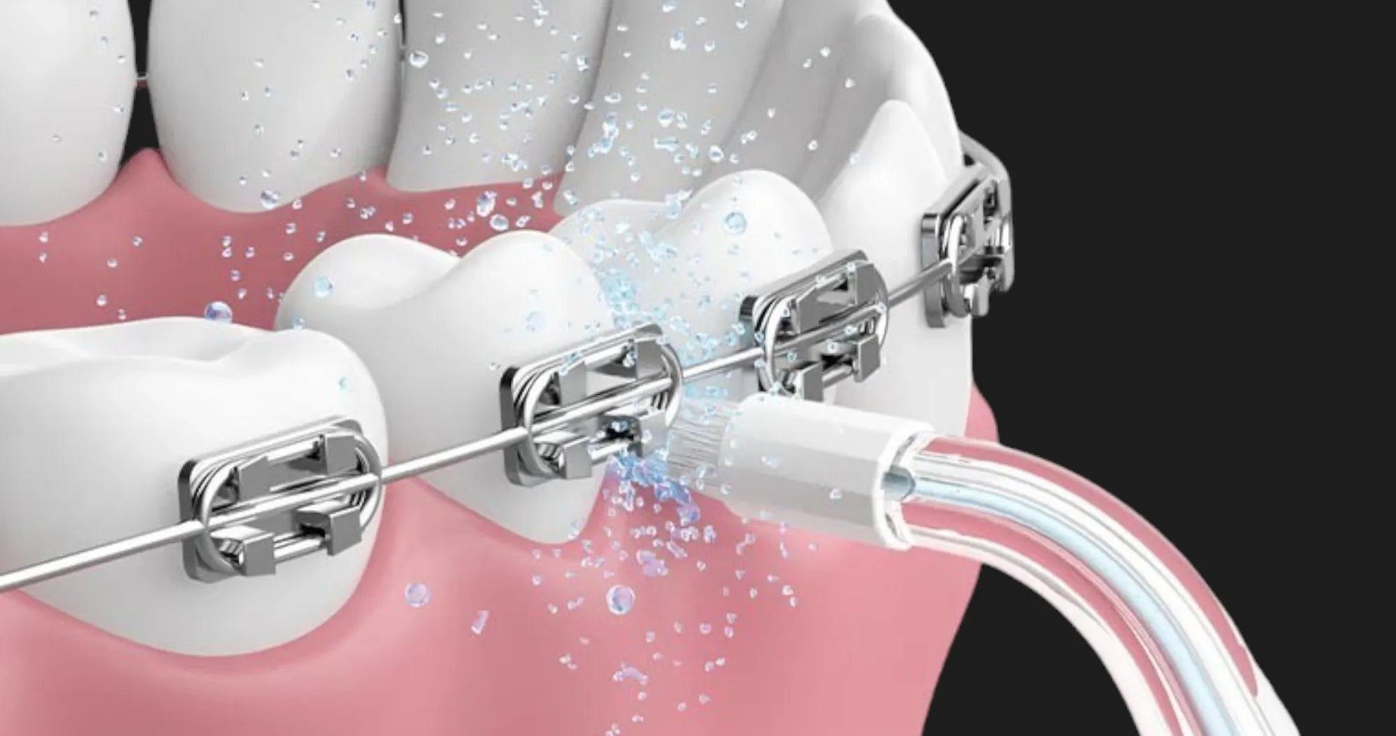 Насадка для ирригатора Oclean Nozzle for A10-Orthodontics