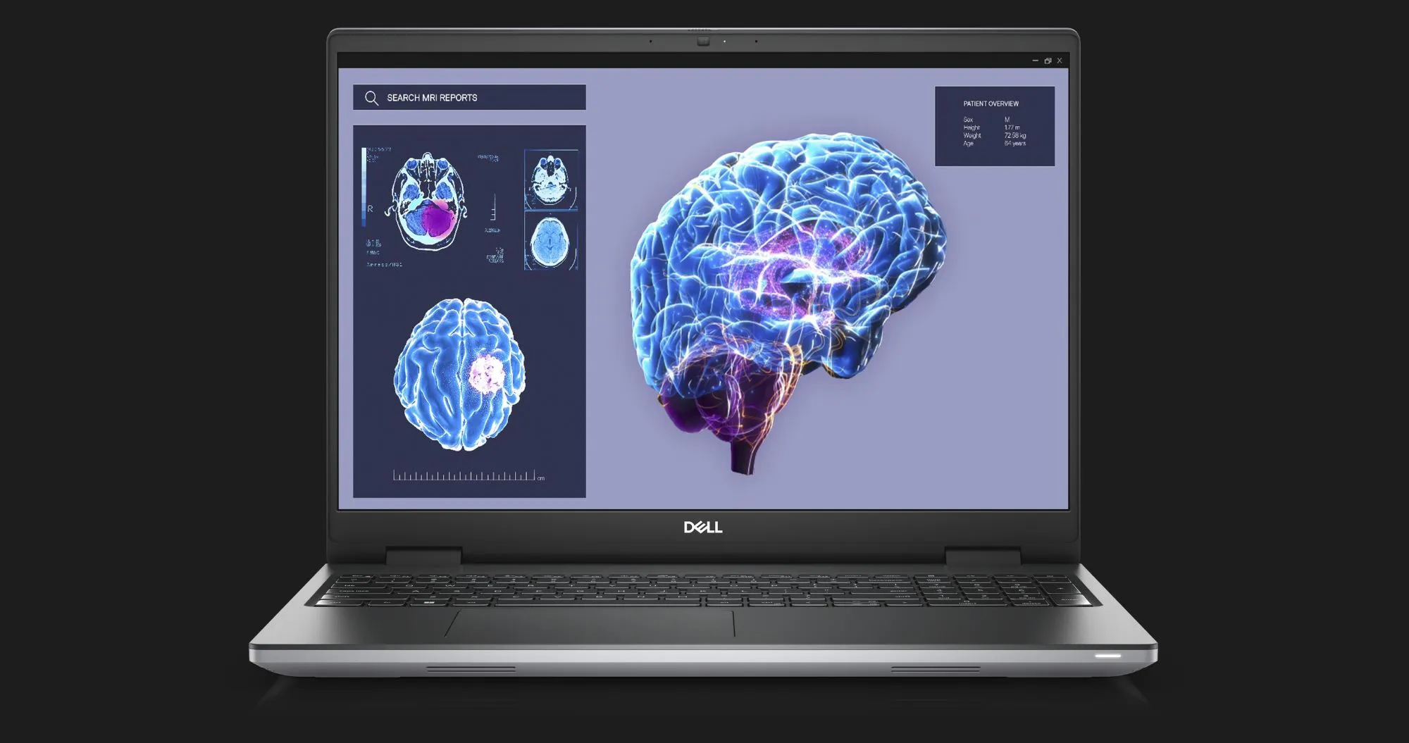 Ноутбук Dell Precision 7680 16" (Intel Core i7/64GB/4TB (SSD)/RTX 1000 ADA) (N007P7680128W1004) (Standard)