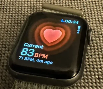 Дослідження підтвердили критичну роль Apple Watch у моніторингу серця після операцій