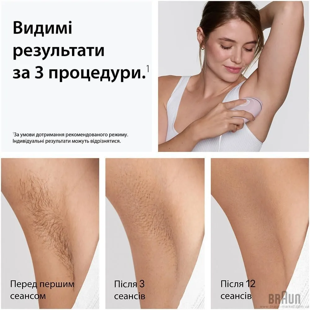 Фотоепілятор BRAUN Silk-expert Mini IPL (PL1111) (Pink) — фото 4