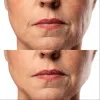 Микротоковый RF лифтинг-массажер MEDICA+ Skin Lifting 7.0 (White)