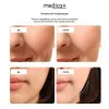 Микротоковый RF лифтинг-массажер MEDICA+ Skin Lifting PRO 10x (Brown)