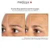 LED-маска MEDICA+ LEDMask 8X (White)