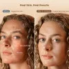 Светодиодная маска RENPHO Artemis LED Light Therapy Mask (Beige)
